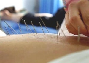 acupuncture-clinic